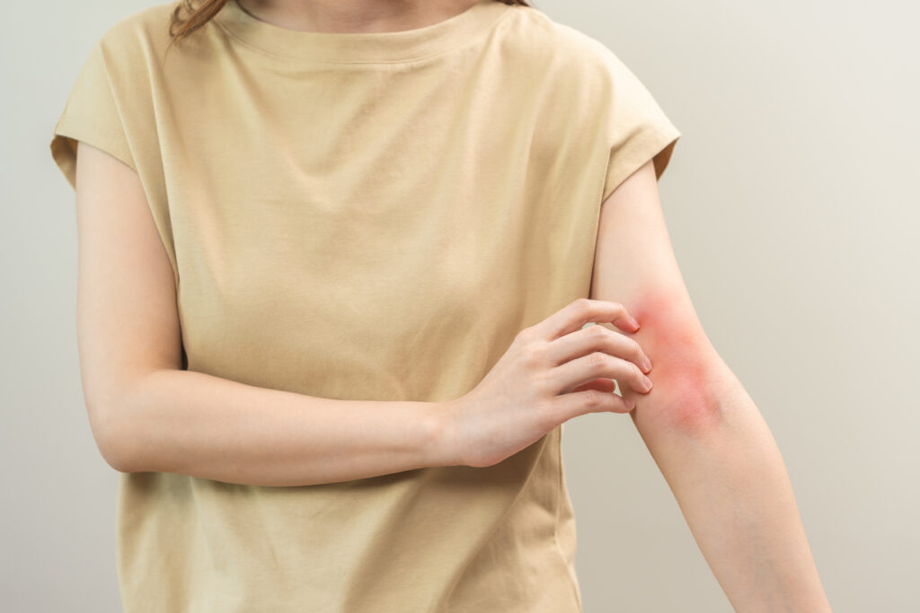 Conseils pour les peaux sèches et l’eczéma atopique
